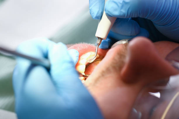 Best Emergency Dental Extractions in St Albans, WV