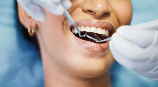 Best Emergency Dentist for Lost Fillings or Crowns in St Albans, WV
