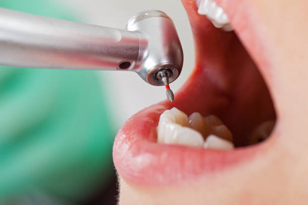 Best Emergency Cosmetic Dentistry in St Albans, WV